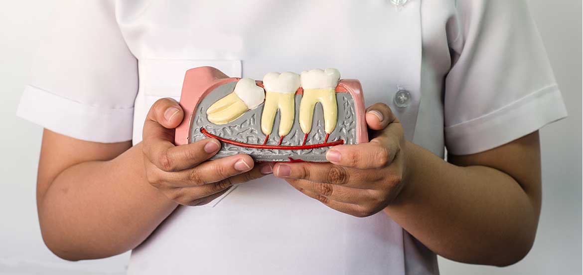 Wisdom-Tooth-Extractions