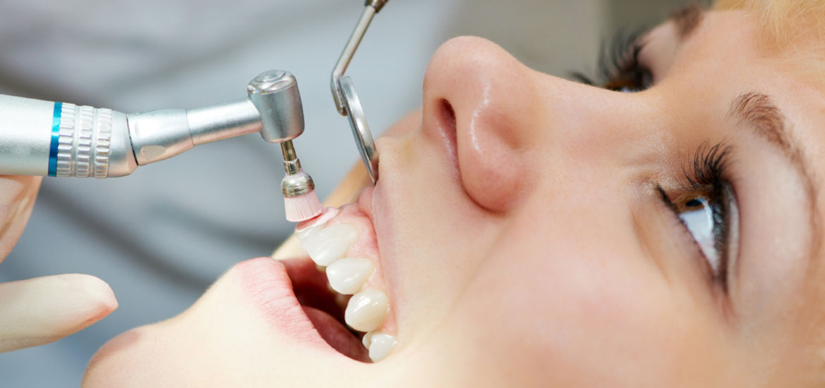 Dental-Cleaning