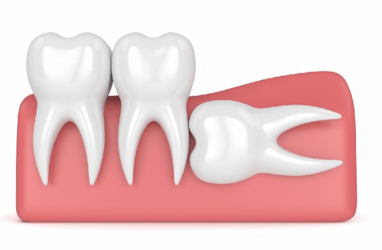 Mentawai Teeth Sharpening A Rite of Passage