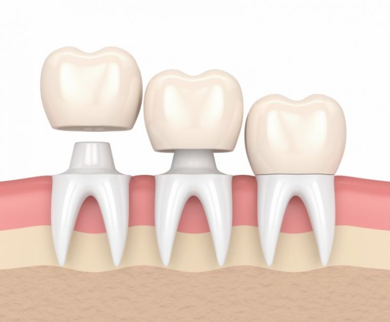Canadian tooth numbering system by the numbers 