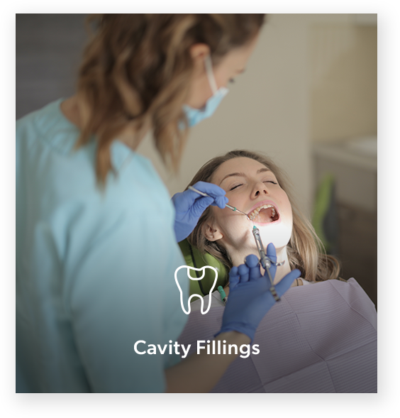 Cavity fillings