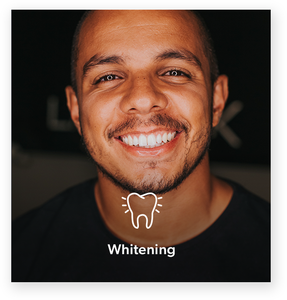 Whitening